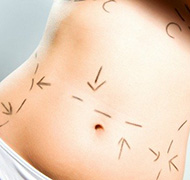Cirurgia Plástica